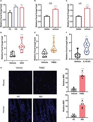 Fungal dysbiosis facilitates inflammatory bowel disease by enhancing CD4+ T cell glutaminolysis